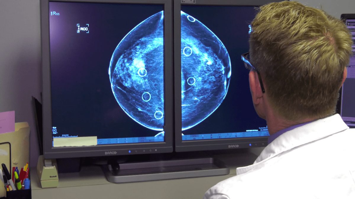 Dr. Brett Parkinson, the medical director of Intermountain Healthcare’s Breast Care Center, reviewing a mammogram.