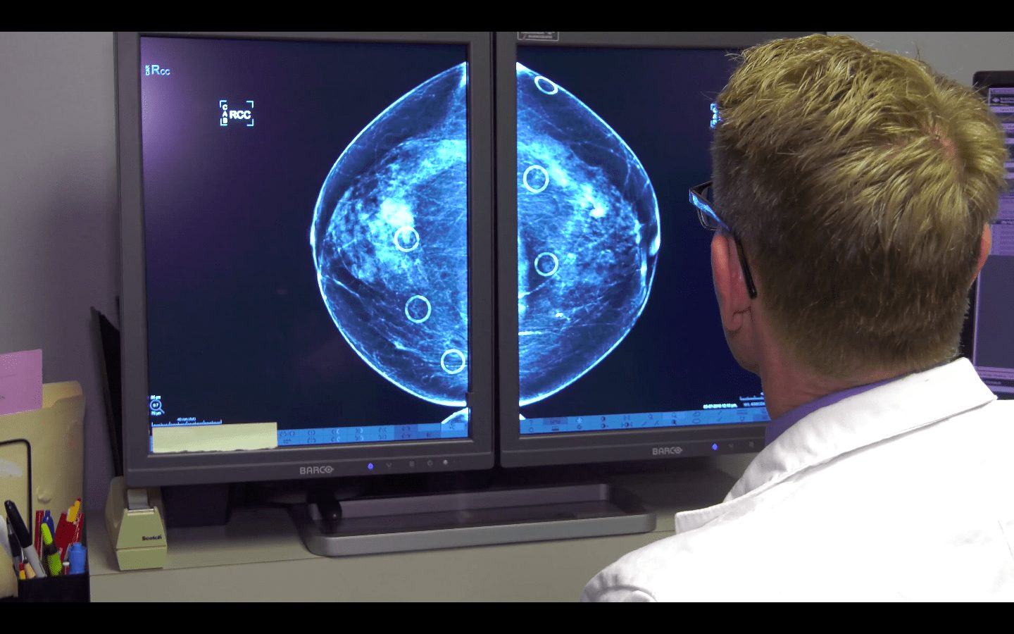 Dr. Brett Parkinson, the medical director of Intermountain Healthcare’s Breast Care Center, reviewing a mammogram.