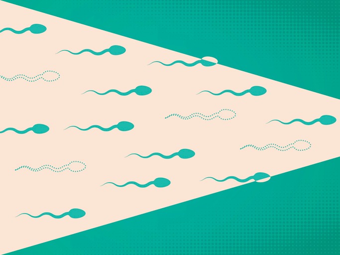 University of Utah Health scientists are testing a new contraceptive gel believed to decreases a man’s sperm production––reducing his chances of fathering a child––without decreasing his sex drive.