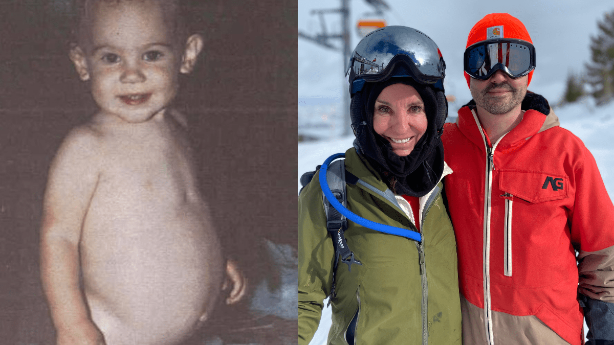 Baby Tyler with his distended belly vs. Tyler and his mom, author Danna Van Noy, now.