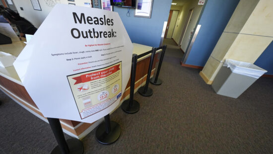A measles sign is seen at the Texas Tech University Health Sciences Center, Feb. 25, 2025, in Lubbock, Texas.