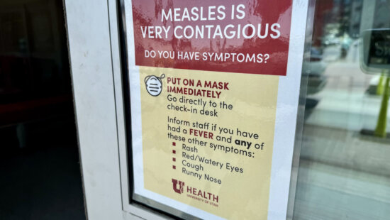 A University of Utah health clinic with a sign warning of measles is pictured in Salt Lake City on June 30, 2025.